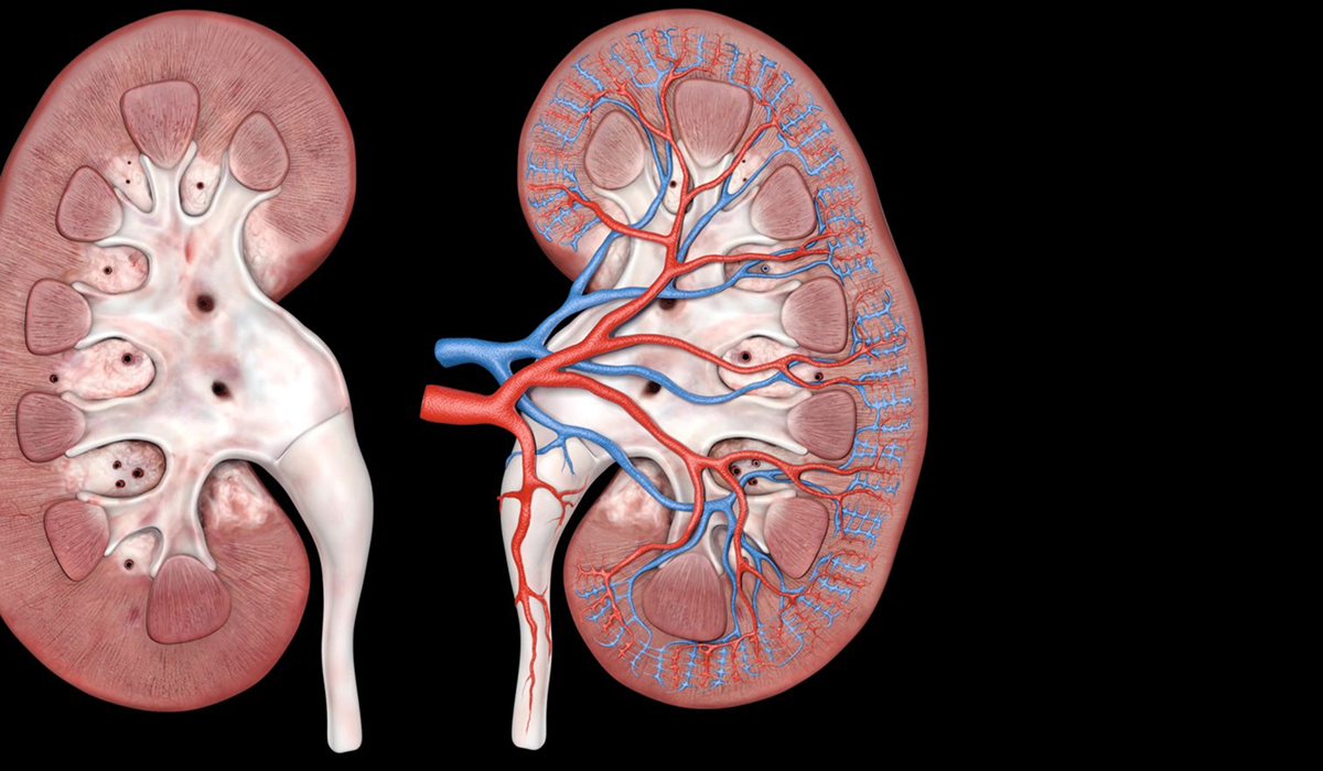 Diabetes and Kidney Disease
